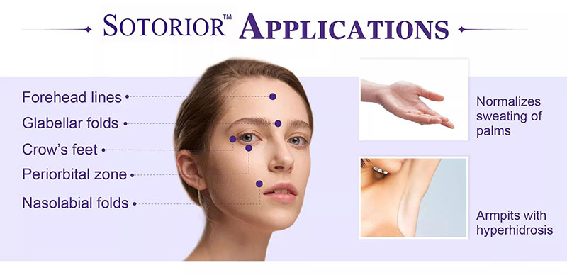 Venta toxina botulinica tipo a