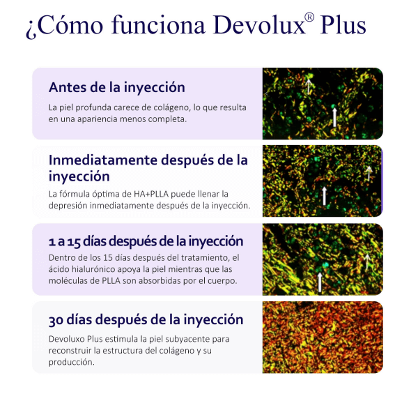 relleno glúteos ácido poliláctico relleno glúteos ácido poliláctico