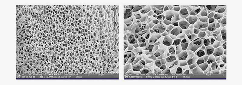 inyección de colágeno inyección de colágeno