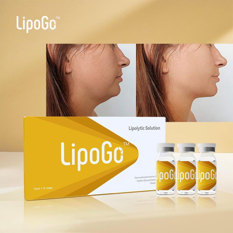 ¿Cómo se elimina la papada sin cirugía ¿Cómo se elimina la papada sin cirugía