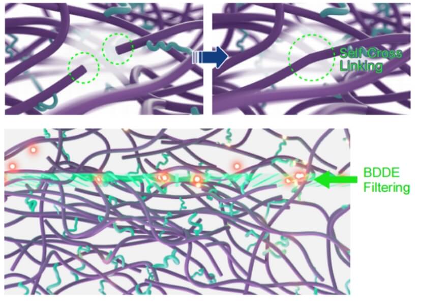 Relleno Corporal con Ácido Hialurónico Relleno Corporal con Ácido Hialurónico