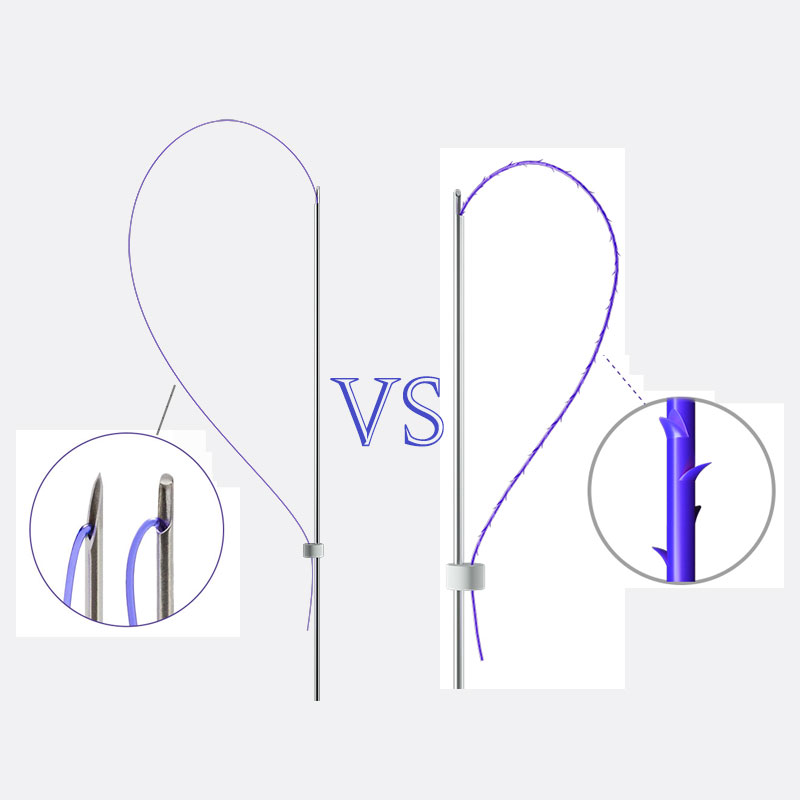 PDO Smooth Threads vs Barbed Threads hilos tensores espiculados