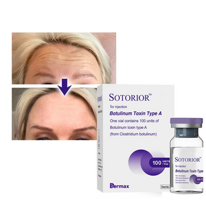 Sotorior® Toxina Botulínica Tipo A Para Arrugas Faciales