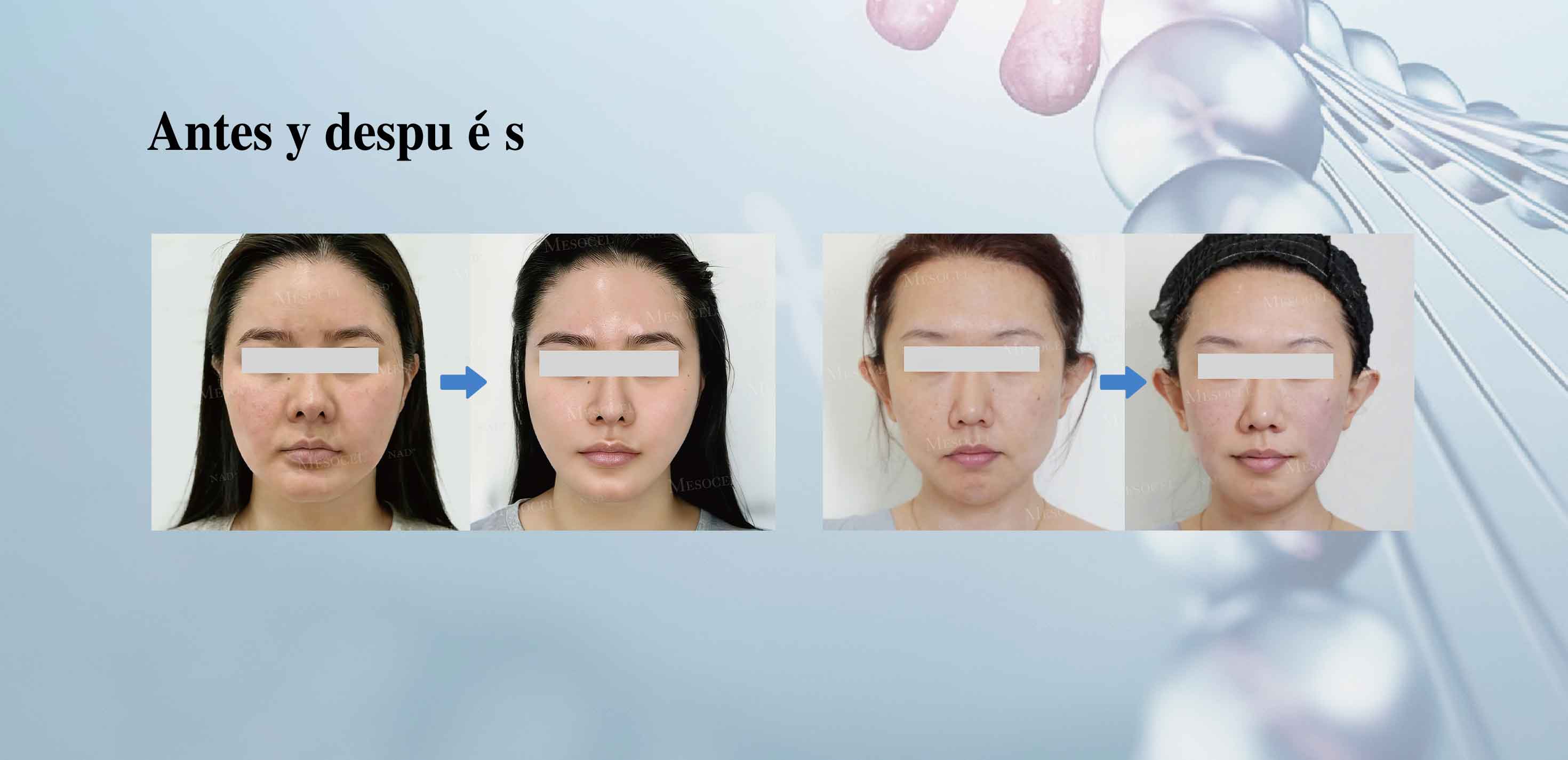 NAD+ para rejuvenecimiento facial