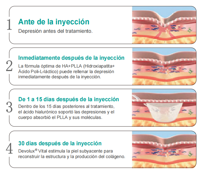 ácido poliláctico precio