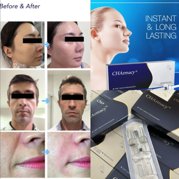 Hidroxiapatita De Calcio Antes Y Después – Charmacy®