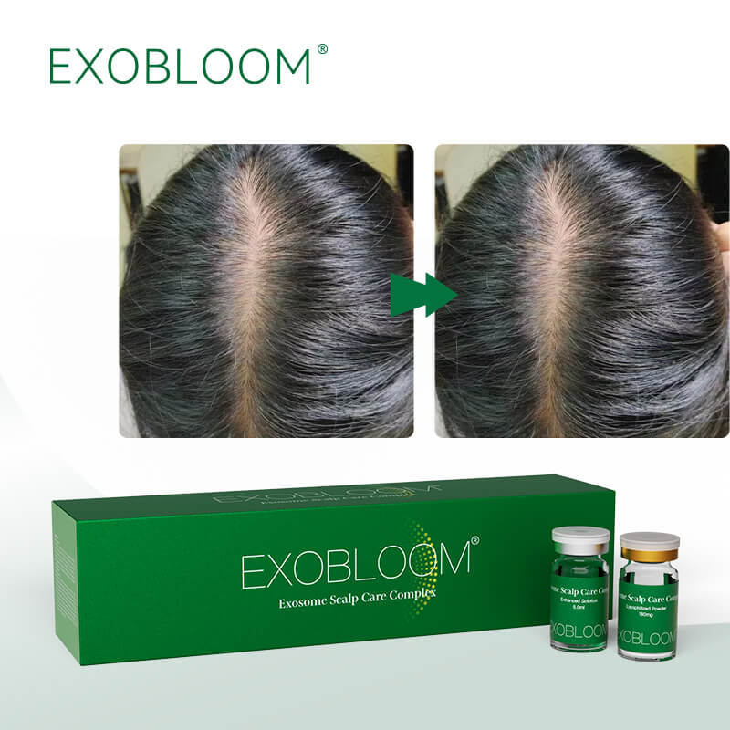 Exosomas Para El Cabello – Solución Profesional Para Regeneración Capilar