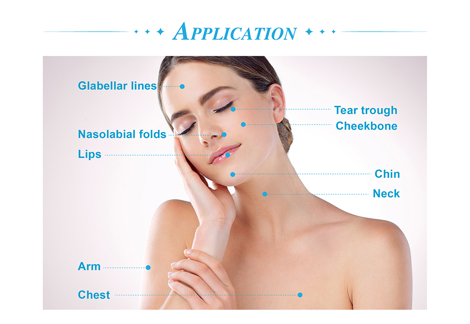 Agujas de mesoterapia