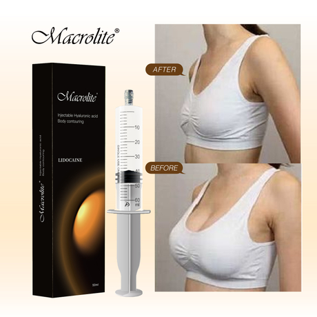 inyecciones de ácido hialurónico para senos.jpg