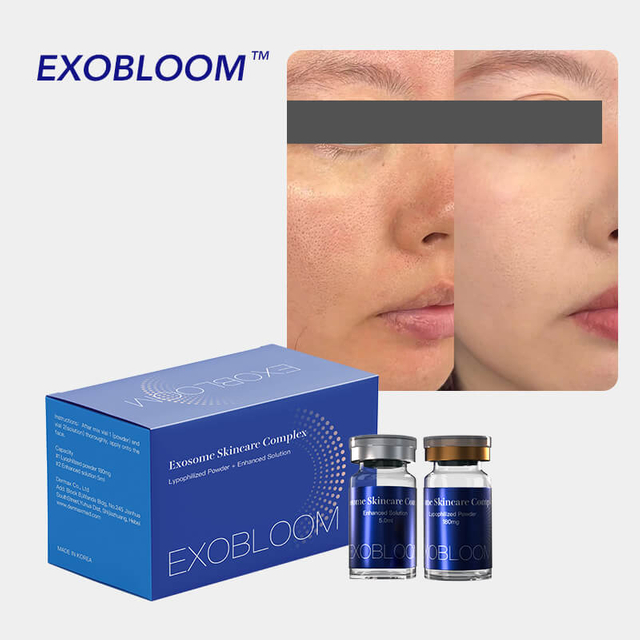 Skin Booster De Exosomas Premium: Exobloom®