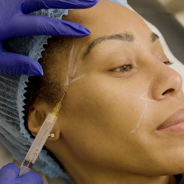 Consejos Clínicos Sobre Cómo Aplicar Ácido Poliláctico