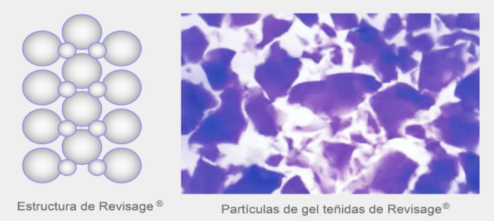 rellenos faciales con &aacute;cido hialur&oacute;nico