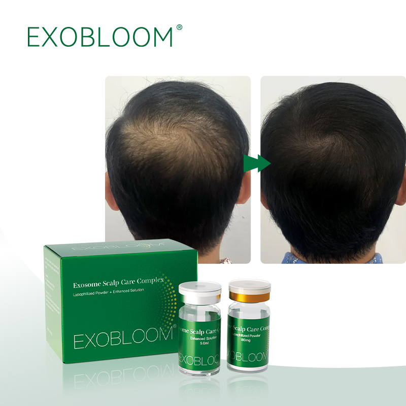 ¿Qué son los Exosomas ¿Qué son los Exosomas