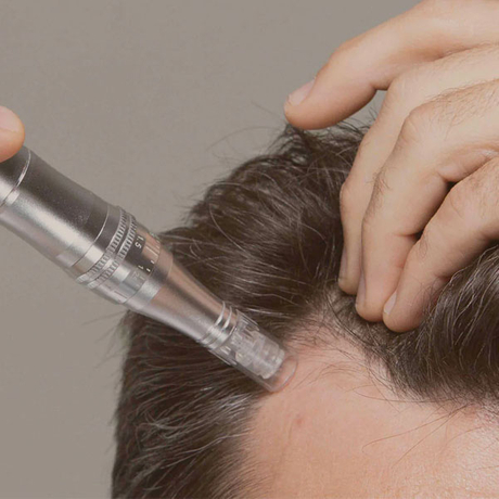 dermapen-exosomas-opiniones.jpg