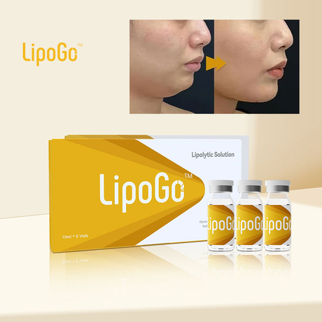 ¿Cómo Se Elimina La Papada Sin Cirugía.jpg