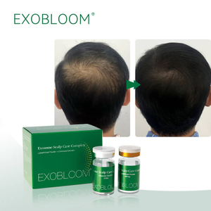 Tratamiento Con Exosomas Capilares Exobloom