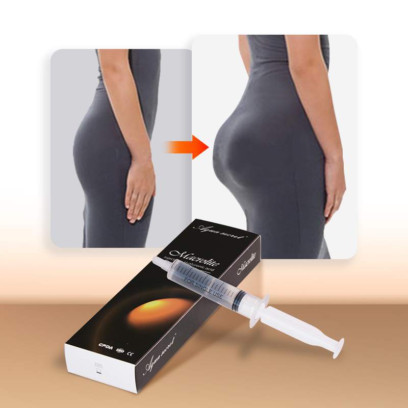 Macrolite relleno de gluteos sin cirugia