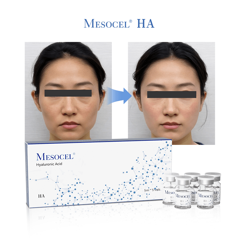Mesocel® Skin Booster De Ácido Hialurónico