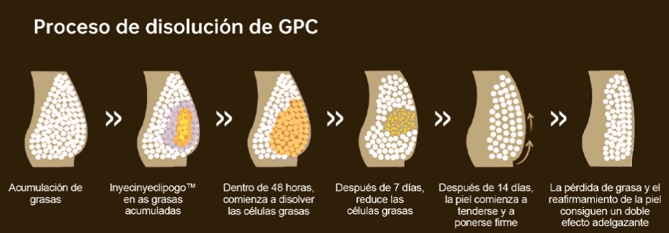 lip&oacute;lisis inyectable precio