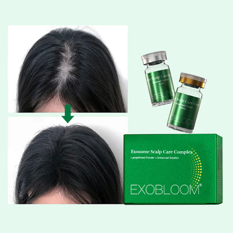 exosomas-para-caida-de-cabello.jpg