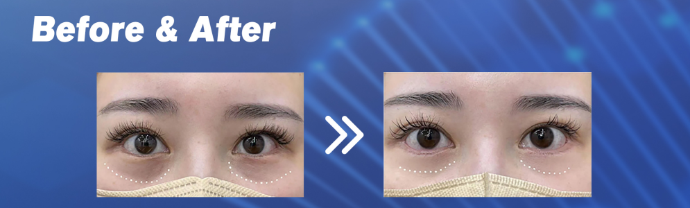 Polinucleótidos Para El Contorno De Ojos