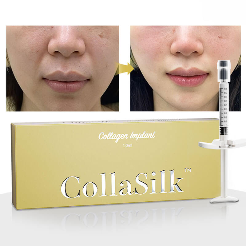 CollaSilk™ Implante De Colágeno