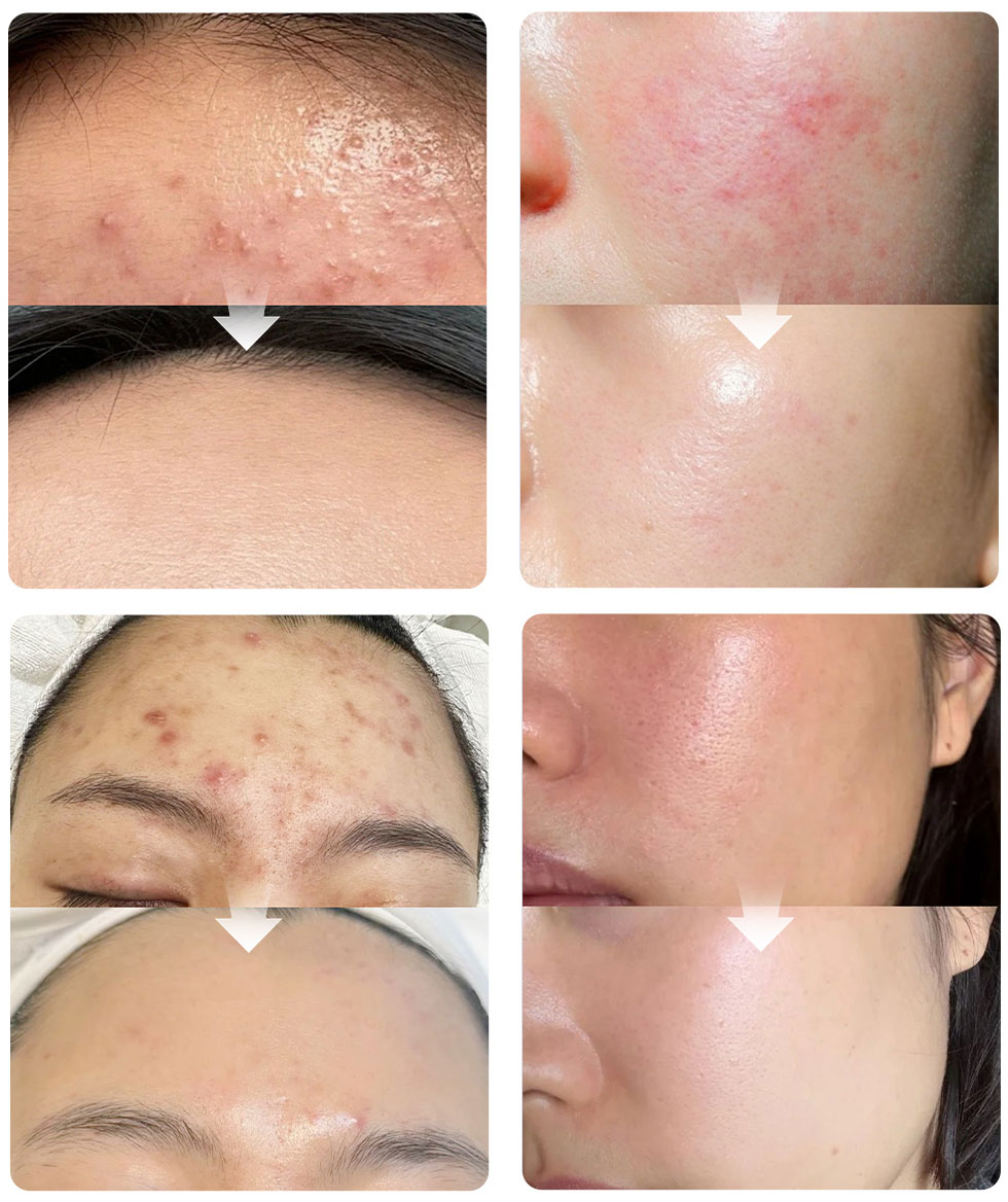 Dual Serum con exosomas y PDRN