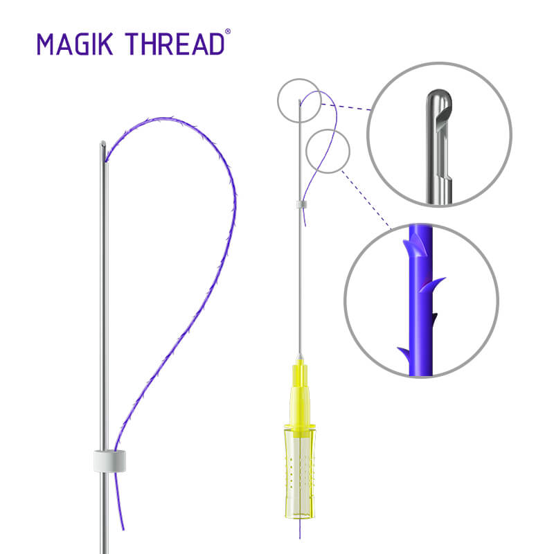 Hilos Tensores Espiculados PDO Magik Thread®