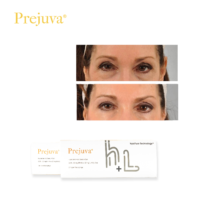 Prejuva® H + L Skinbooster: Precios