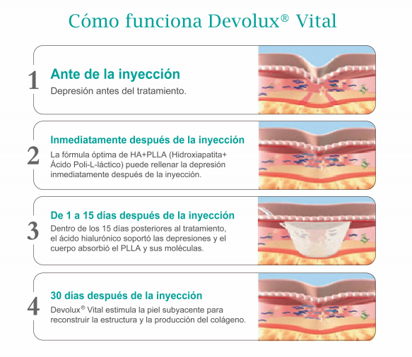 Comprar &Aacute;cido Poli-L-L&aacute;ctico