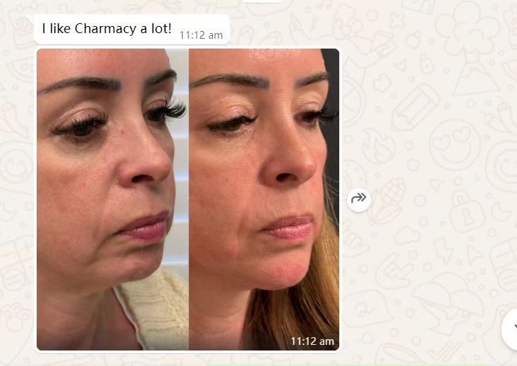 hidroxiapatita de calcio antes y despu&eacute;s