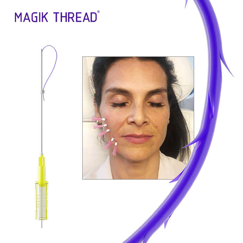Magik-Thread-Hilos-Tensores-de-PDO-Cog-(2)