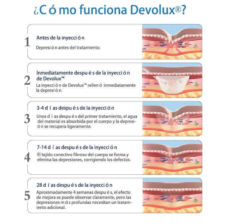 ¿Cómo funciona Devolux®?