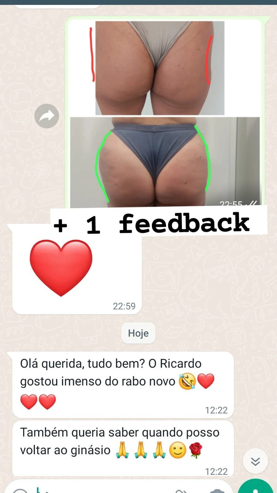 como rellenar los gluteos de los lados