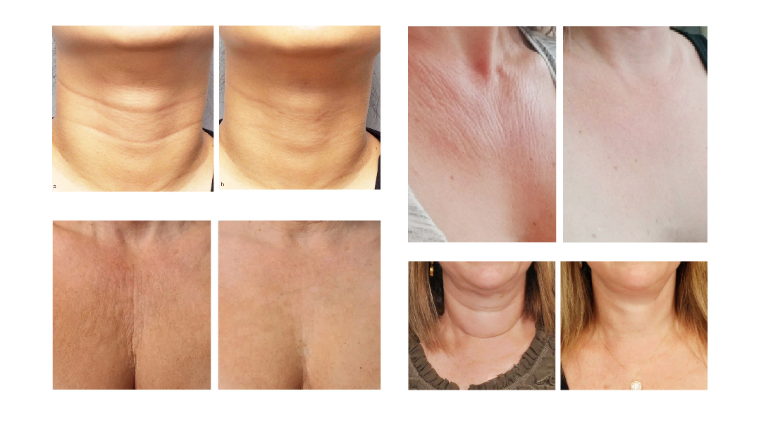 Nutriderm&reg;-hylite_07_02