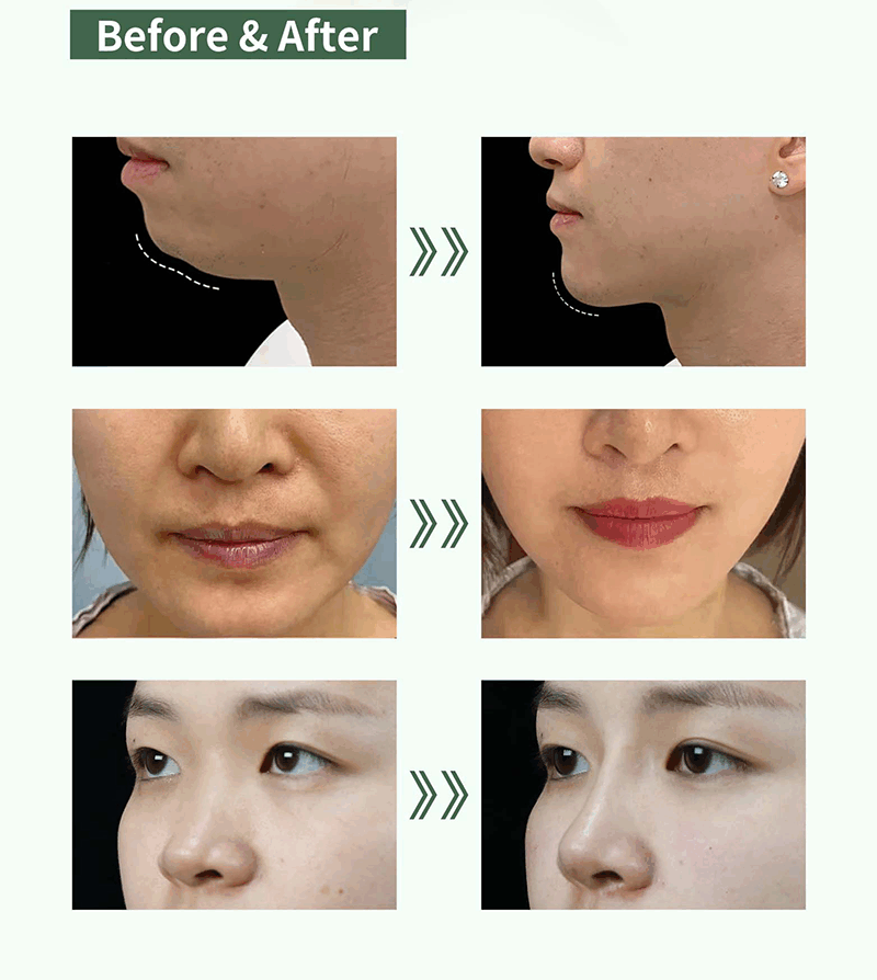 PrimeFill&reg;-CATALOG_08