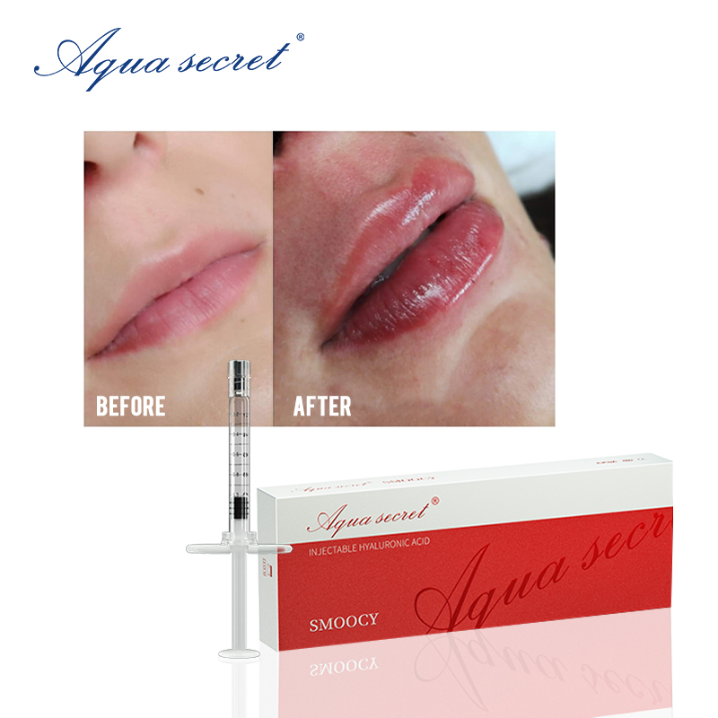 comprar relleno de labios en línea