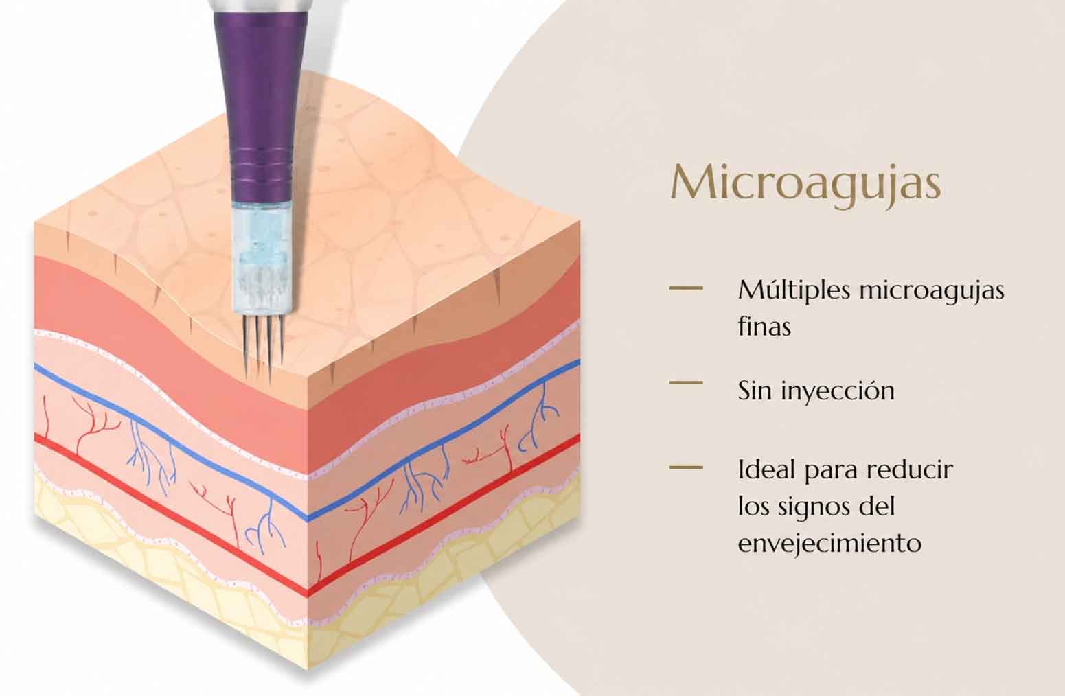 Mesoterapia y Microneedling