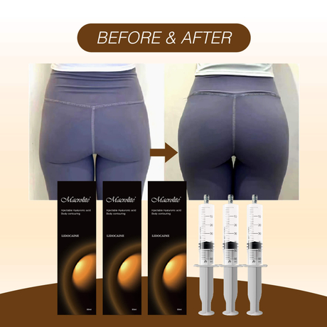 Ácido Hialurónico Glúteos Opiniones.jpg