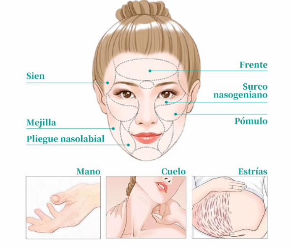 Comprar &Aacute;cido Poli-L-L&aacute;ctico