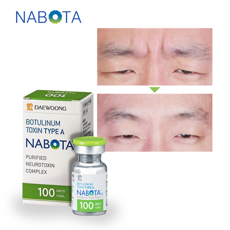 Nabota 200 units price.jpg