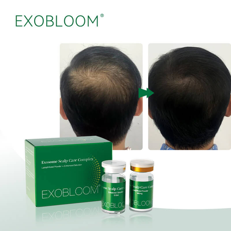 hair exosomes results.jpg