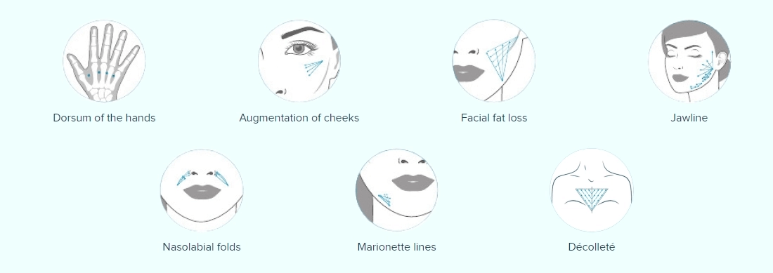 Diferencias entre Ácido Hialurónico e Hidroxiapatita Cálcica