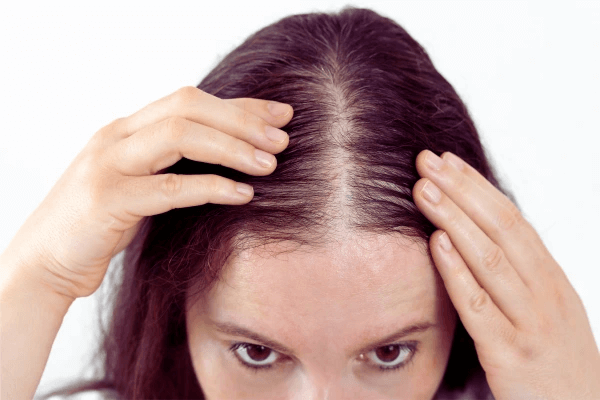 mesoterapia capilar precios