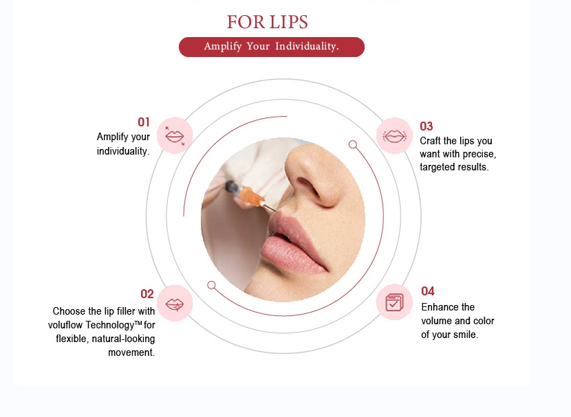 Inyección de labios de relleno dérmico de 1 ml