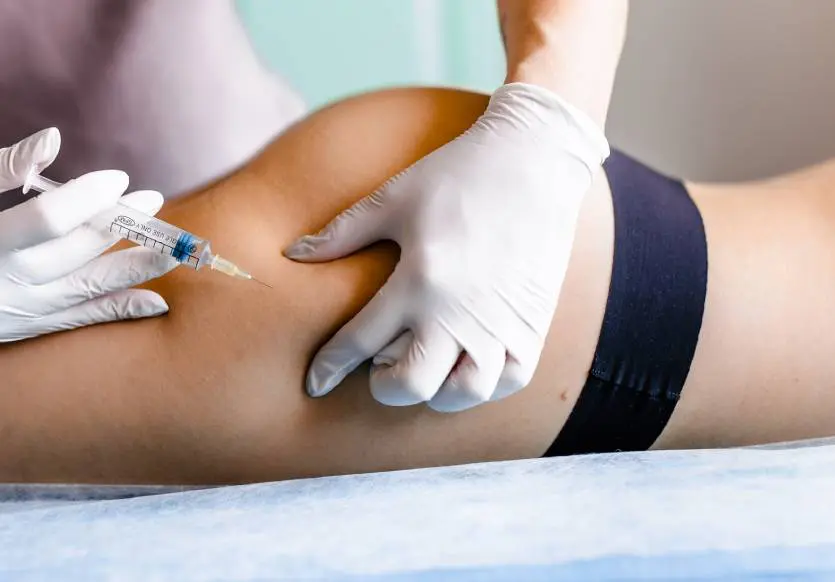 Ácido Poliláctico para Glúteos