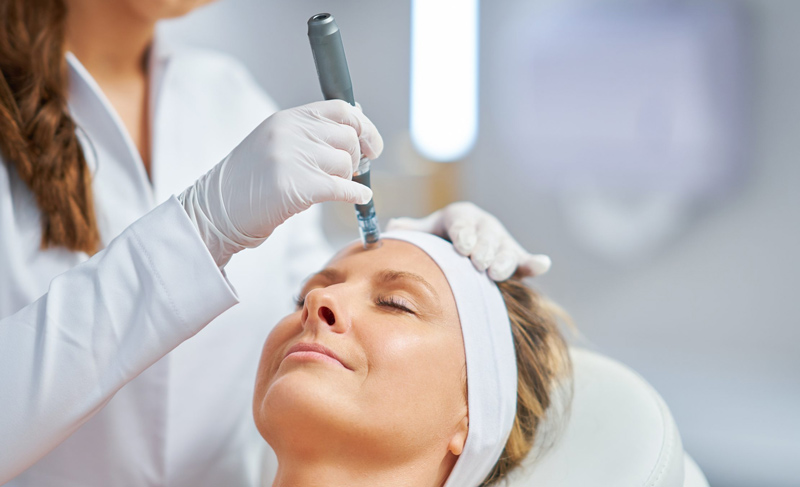 comprar exosomas para dermapen