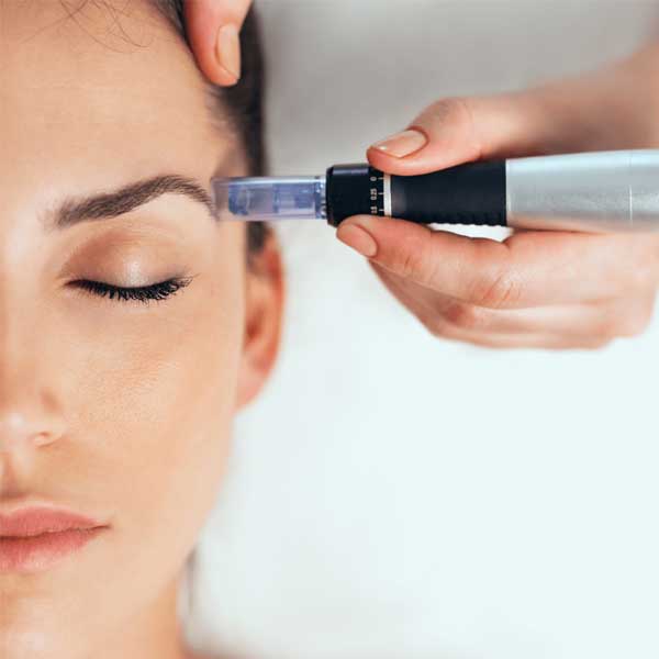 Diferencias Entre Mesoterapia Y Microneedling