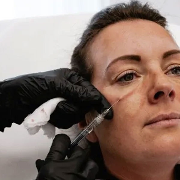 ¿Funcionan Las Inyecciones De Ácido Hialurónico Para Las Bolsas En Los Ojos?