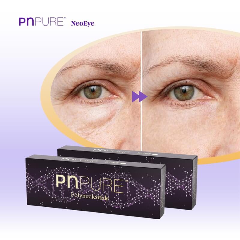 Precio De Polinucleótidos Para Ojos: PNPURE™ NeoEye